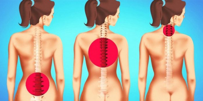 Три упражнения, которые помогут уменьшить боль в спине