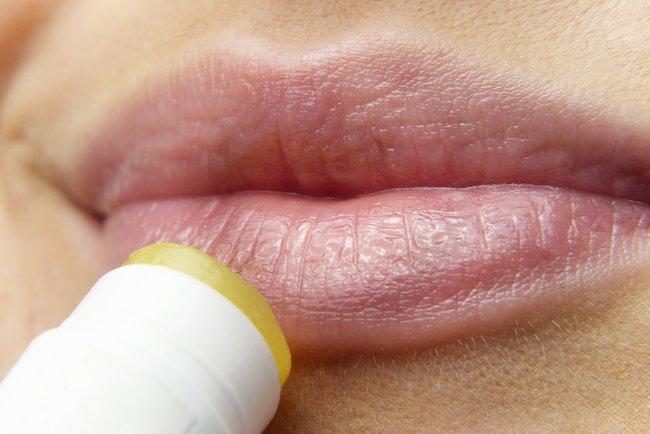 Сухість та тріщини на губах: дерматолог назвала причини