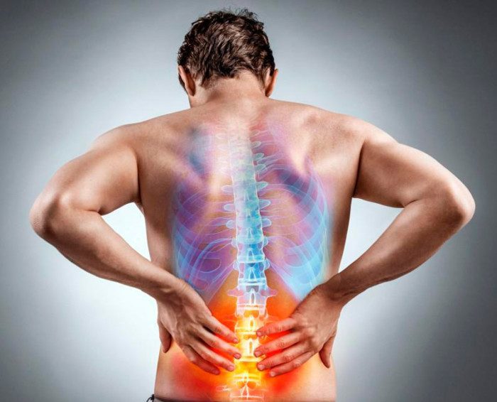 Боль в позвоночнике: как снять воспаление и вывести соли?