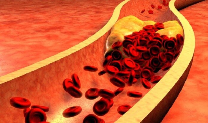 Который популярный во всем мире продукт поднимает уровень холестерина в крови